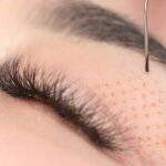Plasmage for Hooded Eyes: Addressing Upper Eyelid Concerns Without Surgery