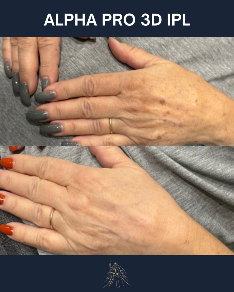 alpha pro ipl prescott arizona