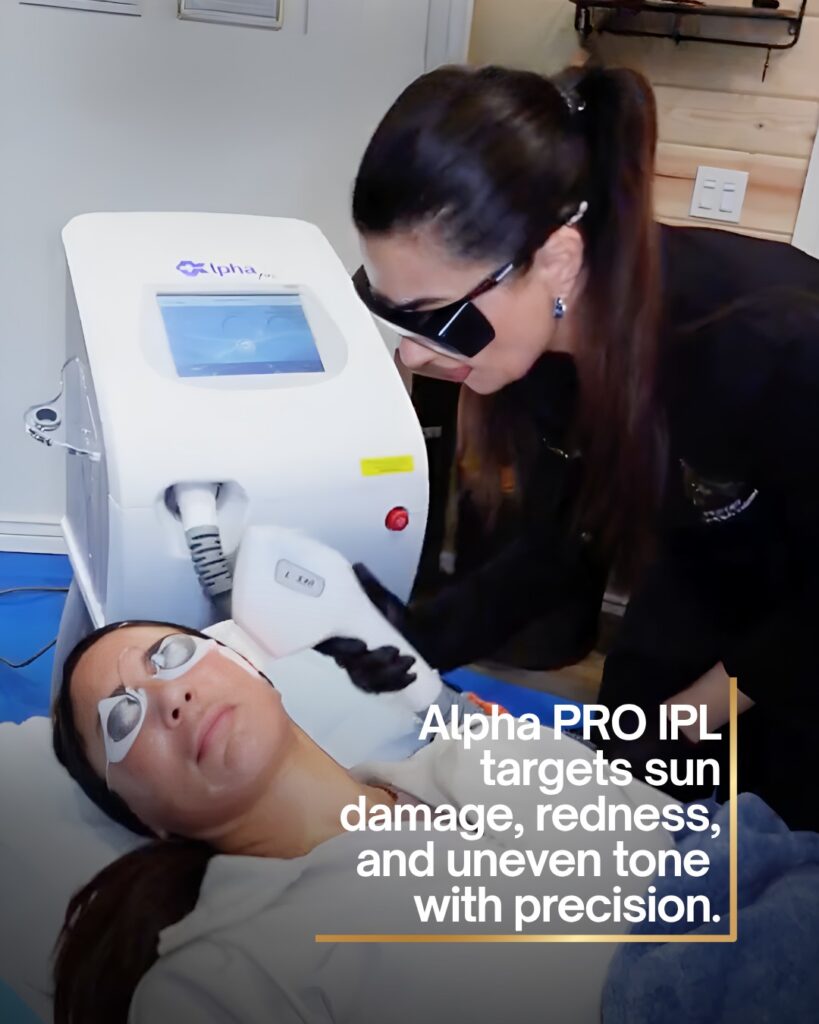Alpha PRO IPL prescott az