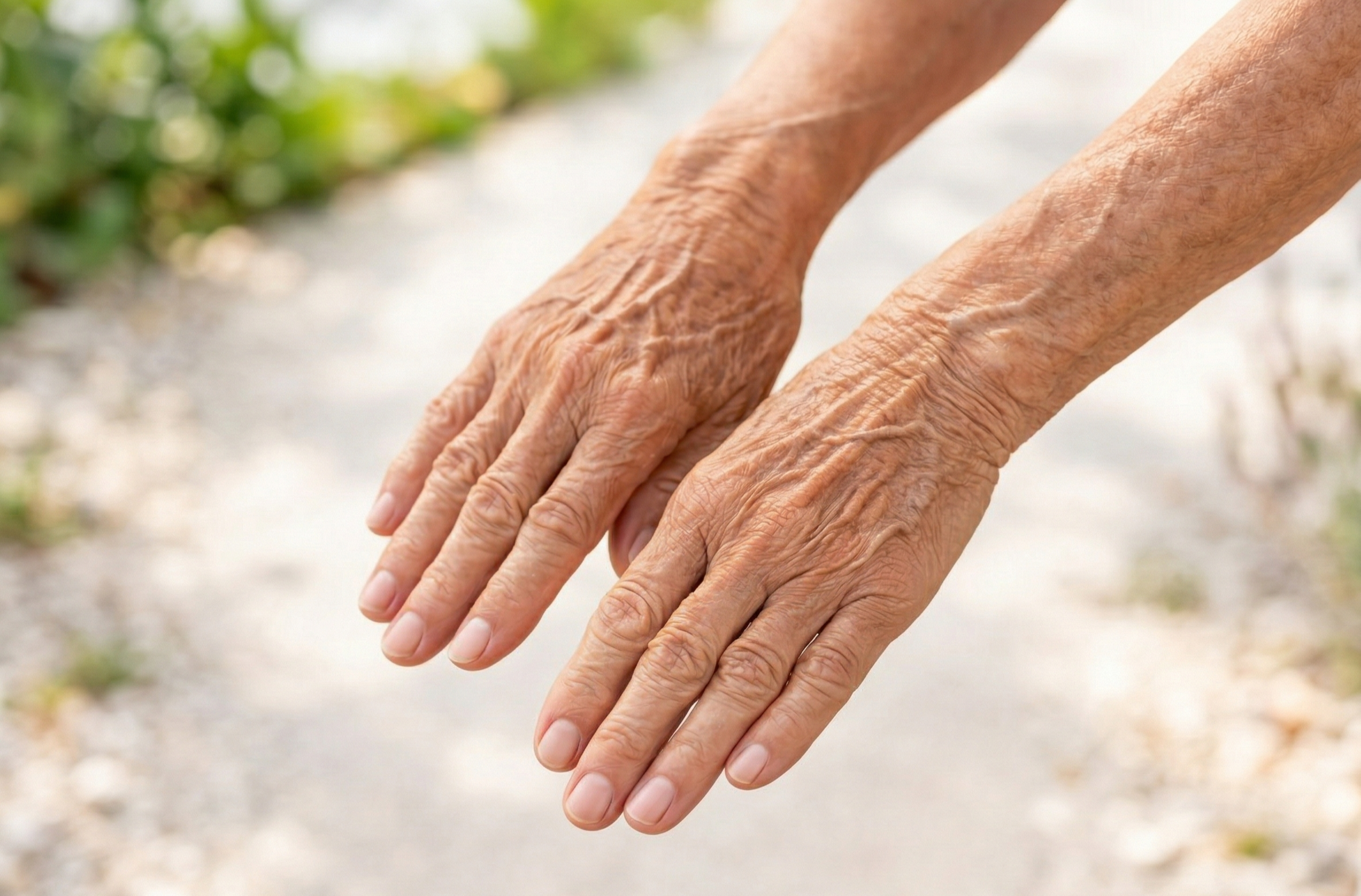 prescott alpha pro 3D ipl